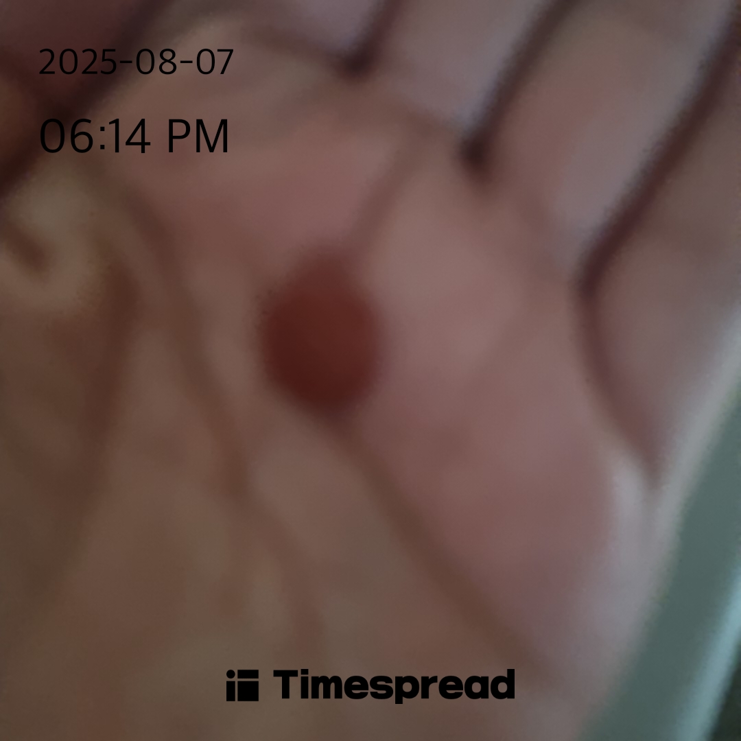 board-img