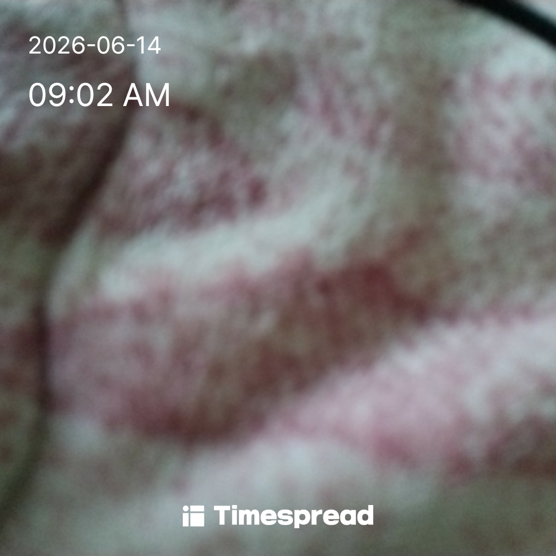 board-img