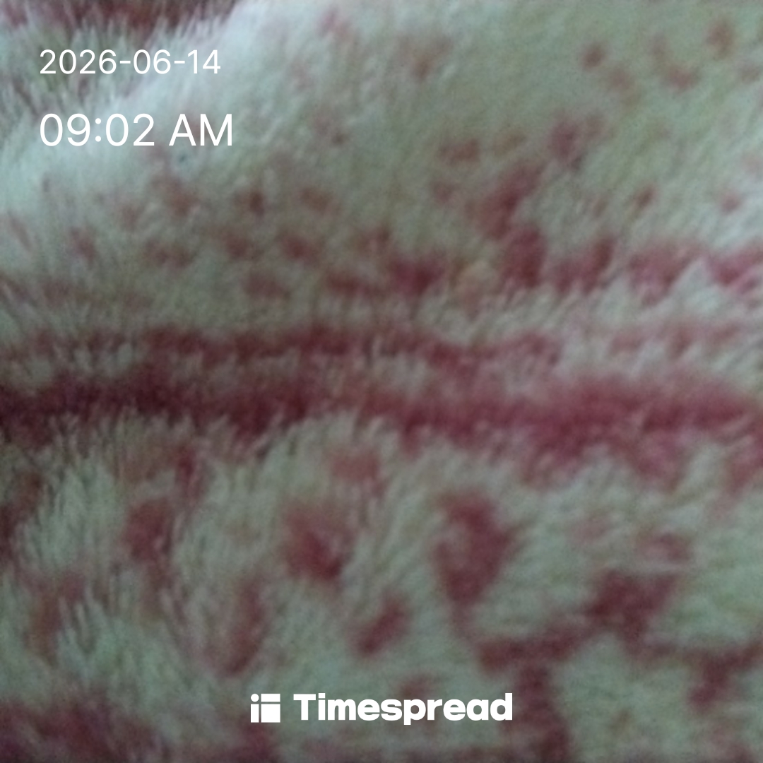 board-img