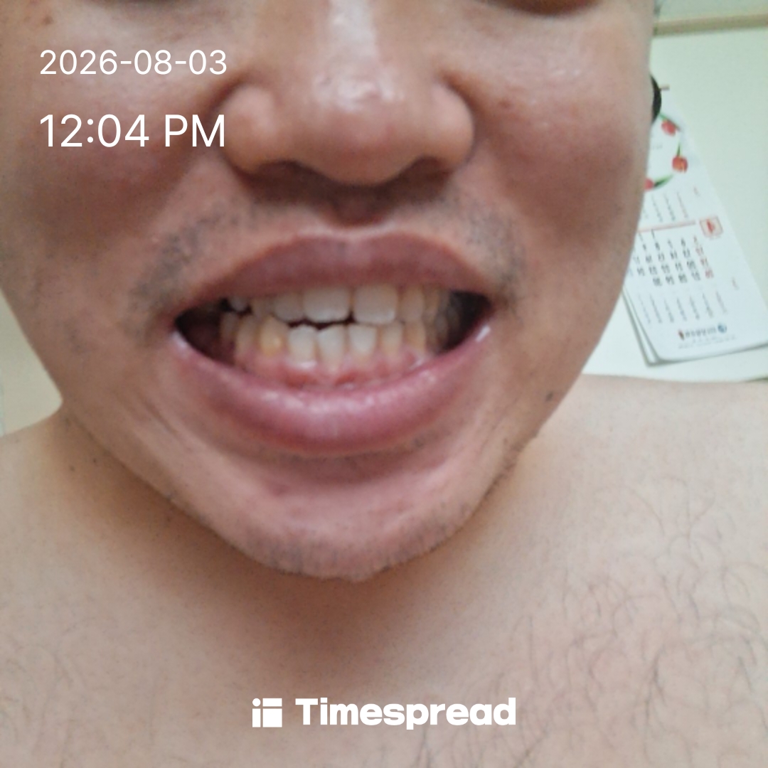 board-img