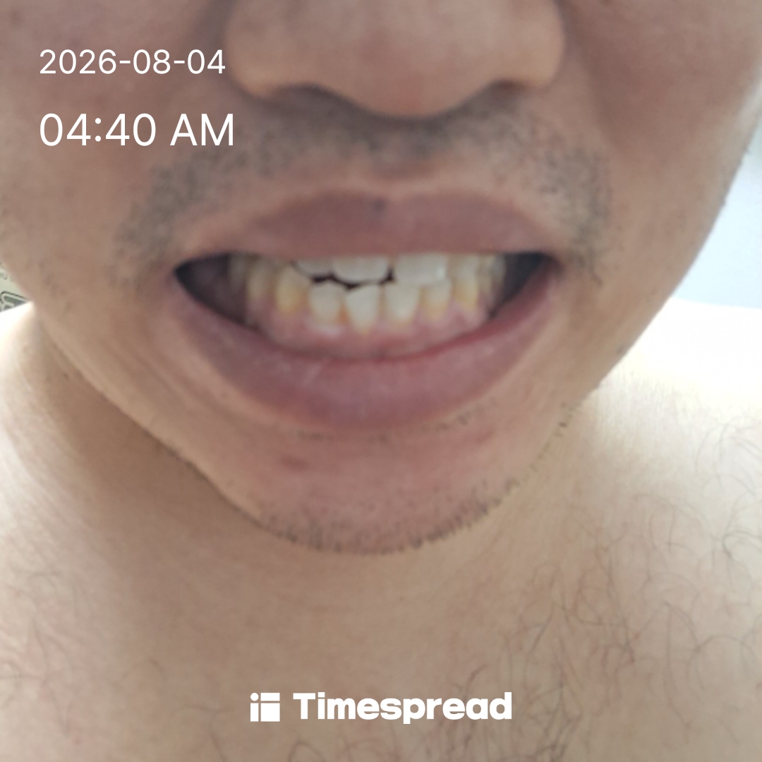 board-img