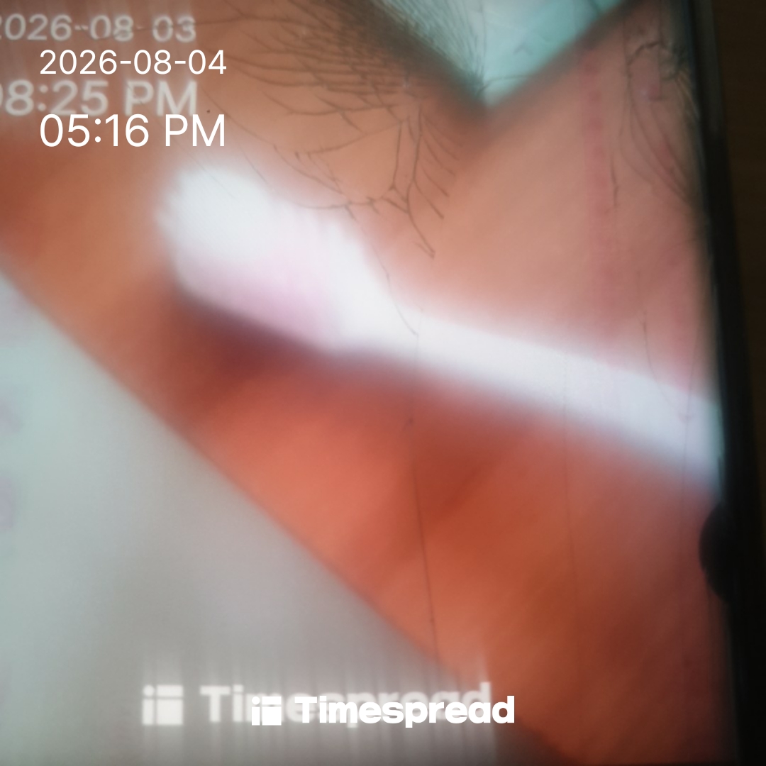 board-img