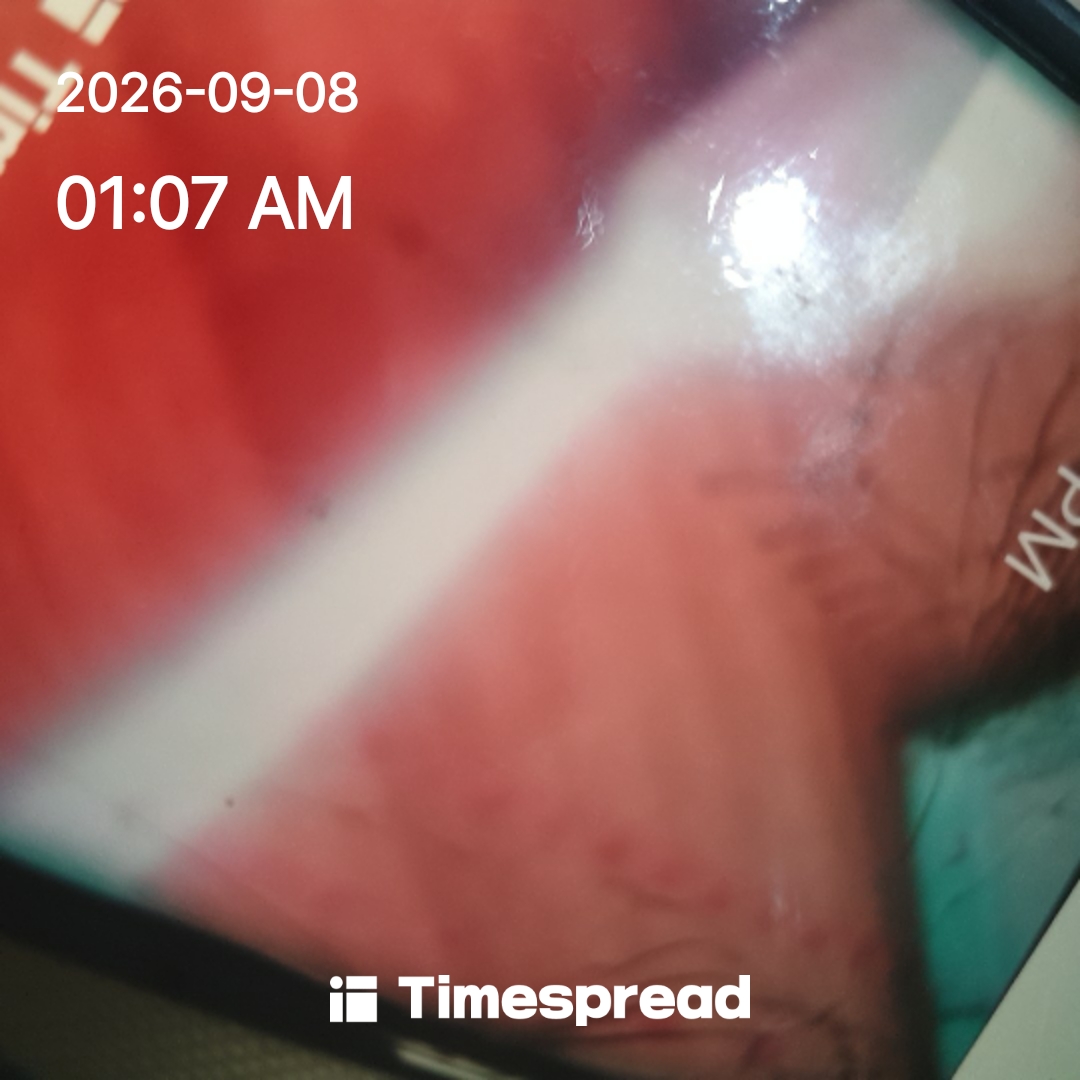 board-img